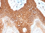 IHC staining of FFPE human cervix with recombinant E-Cadherin antibody (clone CDH1/4398R). HIER: boil tissue sections in pH 9 10mM Tris with 1mM EDTA for 20 min and allow to cool before testing.