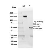 SDS-PAGE analysis of purified, BSA-free Follistatin antibody (clone FST/4281) as confirmation of integrity and purity.