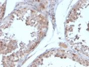 IHC staining of FFPE human testis with Follistatin antibody (clone FST/4281). HIER: boil tissue sections in pH 9 10mM Tris with 1mM EDTA for 20 min and allow to cool before testing.