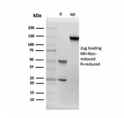 SDS-PAGE analysis of purified, BSA-free Aromatase antibody (clone CYP19A1/4257) as confirmation of integrity and purity.
