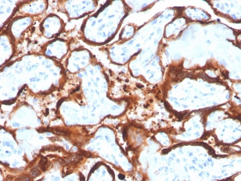 IHC staining of FFPE human placenta with Aromatase antibody (clone CYP19A1/4257). HIER: boil tissue sections in pH 9 10mM Tris with 1mM EDTA for 20 min and allow to cool before testing.~