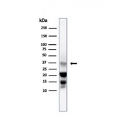 Western blot testing of human testis lysate with DAZL antibody. Predicted molecular weight: ~32 kDa.