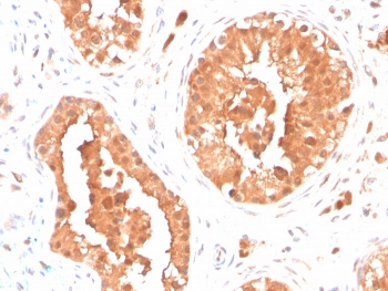 IHC staining of FFPE human testis with DAZL antibody. HIER: boil tissue sections in pH 9 10mM Tris with 1mM EDTA for 20 min and allow to cool before testing.