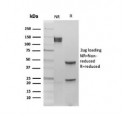 SDS-PAGE analysis of purified, BSA-free Estrogen Receptor beta 1 antibody (clone PPG5/10) as confirmation of integrity and purity.