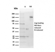 SDS-PAGE analysis of purified, BSA-free Estrogen Receptor beta 2 antibody (clone 57/3) as confirmation of integrity and purity.