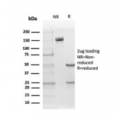 SDS-PAGE analysis of purified, BSA-free Estrogen Receptor beta 5 antibody (clone PPG5/25) as confirmation of integrity and purity.