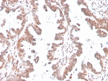 IHC staining of FFPE human ovary with GDF9 antibody. HIER: boil tissue sections in pH 9 10mM Tris with 1mM EDTA for 20 min and allow to cool before testing.~