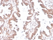 IHC staining of FFPE human ovary with GDF9 antibody (clone GDF9/4261). HIER: boil tissue sections in pH 9 10mM Tris with 1mM EDTA for 20 min and allow to cool before testing.