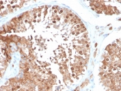 IHC staining of FFPE human testis with Inhibin alpha antibody (clone INHA/4266). HIER: boil tissue sections in pH 9 10mM Tris with 1mM EDTA for 20 min and allow to cool before testing.
