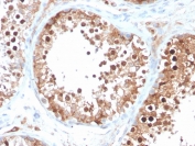 IHC staining of FFPE human testis with Inhibin alpha antibody (clone INHA/4266). HIER: boil tissue sections in pH 9 10mM Tris with 1mM EDTA for 20 min and allow to cool before testing.