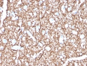 IHC staining of FFPE human brain with MBP antibody. HIER: boil tissue sections in pH 9 10mM Tris with 1mM EDTA for 20 min and allow to cool before testing.