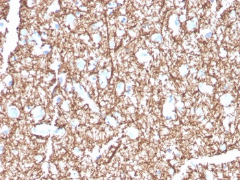 IHC staining of FFPE human brain with MBP antibody. HIER: boil tissue sections in pH 9 10mM Tris with 1mM EDTA for 20 min and allow to cool before testing.