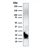 Western blot testing of human brain lysate with MBP antibody. Isoforms may be visualized from 20~37 kDa.