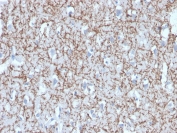 IHC staining of FFPE human brain with MBP antibody. HIER: boil tissue sections in pH 9 10mM Tris with 1mM EDTA for 20 min and allow to cool before testing.