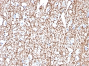 IHC staining of FFPE human brain with MBP antibody. HIER: boil tissue sections in pH 9 10mM Tris with 1mM EDTA for 20 min and allow to cool before testing.