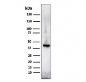 Western blot testing of human U-87 MG cell lysate with MBP antibody. Isoforms may be visualized from 20~37 kDa.