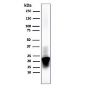 Western blot testing of human brain lysate with Myelin Basic Protein antibody (clone MBP/4273). Isoforms may be visualized from 20~37 kDa.