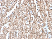 IHC staining of FFPE human brain with Myelin Basic Protein antibody (clone MBP/4273). HIER: boil tissue sections in pH 9 10mM Tris with 1mM EDTA for 20 min and allow to cool before testing.