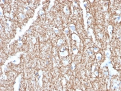 IHC staining of FFPE human brain with Myelin Basic Protein antibody (clone MBP/4273). HIER: boil tissue sections in pH 9 10mM Tris with 1mM EDTA for 20 min and allow to cool before testing.