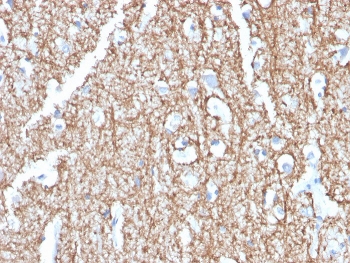 IHC staining of FFPE human brain with Myelin Basic Protein antibody (clone MBP/4273). HIER: boil tissue sections in pH 9 10mM Tris with 1mM EDTA for 20 min and allow to cool before testing.