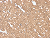 IHC staining of FFPE human brain with Myelin Basic Protein antibody (clone MBP/4274). HIER: boil tissue sections in pH 9 10mM Tris with 1mM EDTA for 20 min and allow to cool before testing.
