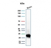 Western blot testing of human brain lysate with Myelin Basic Protein antibody (clone MBP/4275). Isoforms may be visualized from 20~37 kDa.