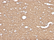 IHC staining of FFPE human brain with Myelin Basic Protein antibody (clone MBP/4275). HIER: boil tissue sections in pH 9 10mM Tris with 1mM EDTA for 20 min and allow to cool before testing.