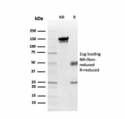 SDS-PAGE analysis of purified, BSA-free Myelin Basic Protein antibody (clone MBP/4275) as confirmation of integrity and purity.