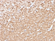 IHC staining of FFPE human brain with Myelin Basic Protein antibody (clone MBP/4276). HIER: boil tissue sections in pH 9 10mM Tris with 1mM EDTA for 20 min and allow to cool before testing.