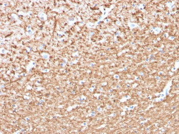 IHC staining of FFPE human brain with Myelin Basic Protein antibody (clone MBP/4276). HIER: boil tissue sections in pH 9 10mM Tris with 1mM EDTA for 20 min and allow to cool before testing.