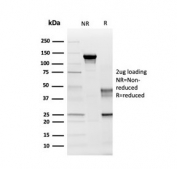 SDS-PAGE analysis of purified, BSA-free Myelin PLP antibody (clone PLP1/4259) as confirmation of integrity and purity.