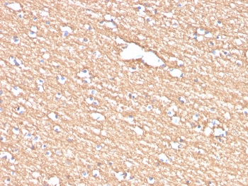 IHC staining of FFPE human brain with Myelin PLP antibody (clone PLP1/4259). HIER: boil tissue sections in pH 9 10mM Tris with 1mM EDTA for 20 min and allow to cool before testing.~