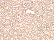 IHC staining of FFPE human brain with Myelin PLP antibody (clone PLP1/4259). HIER: boil tissue sections in pH 9 10mM Tris with 1mM EDTA for 20 min and allow to cool before testing.