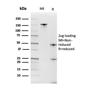 SDS-PAGE analysis of purified, BSA-free ITLN1 antibody as confirmation of integrity and purity.