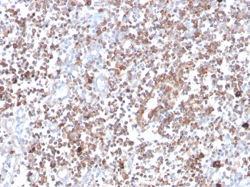 IHC staining of FFPE human tonsil with PRKCA antibody (clone 133). HIER: boil tissue sections in pH 9 10mM Tris with 1mM EDTA for 20 min and allow to cool before testing.~