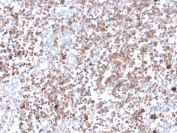 IHC staining of FFPE human tonsil with PRKCA antibody (clone 133). HIER: boil tissue sections in pH 9 10mM Tris with 1mM EDTA for 20 min and allow to cool before testing.