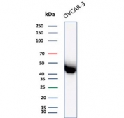 Western blot testing of human OVCAR-3 cell lysate with Mesothelin antibody. Predicted molecular weight ~70 kDa (precursor), ~40 kDa (processed form).