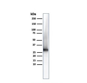 Western blot testing of human kidney lysate with Adiponectin antibody. Predicted molecular weigth ~30 kDa.~