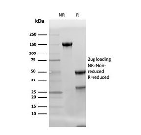 SDS-PAGE analysis of purified, BSA-free Adiponectin antibody (clone ADPN/4256) as confirmation of integrity and purity.