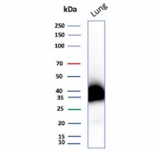 Western blot testing of human lung tissue lysate with recombinant Podoplanin antibody. Predicted molecular weight ~25 kDa but may be observed at higher molecular weights due to glycosylation.
