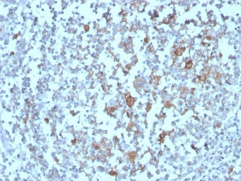 IHC staining of FFPE human tonsil with BAFF-R antibody. HIER: boil tissue sections in pH 9 10mM Tris with 1mM EDTA for 20 min and allow to cool before testing.~