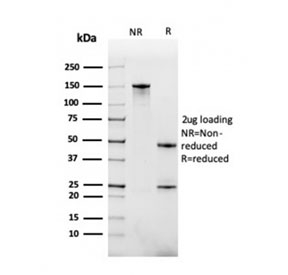 SDS-PAGE analysis of purified, BSA-free BAFF-R antibody as confirmation of i