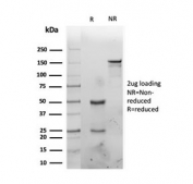 SDS-PAGE analysis of purified, BSA-free IL1A antibody as confirmation of integrity and purity.