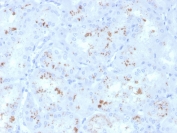 IHC staining of FFPE human kidney with Retinol Binding Protein 4 antibody (clone RBP4/4050). HIER: boil tissue sections in pH 9 10mM Tris with 1mM EDTA for 20 min and allow to cool before testing.