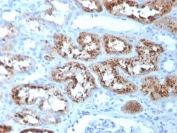 IHC staining of FFPE human kidney with RBP4 antibody (clone RBP4/4051). HIER: boil tissue sections in pH 9 10mM Tris with 1mM EDTA for 20 min and allow to cool before testing.