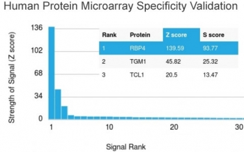 Analysis of HuProt(TM) microarray containing more than 19,000 full-length human proteins using RBP4 antibody. These results demonstrate the foremost specificity of the RBP4/4053 mAb. Z- and S- score: The Z-score represents the strength of a signal that an antibody (in combination with a fluorescently-tagged anti-IgG secondary Ab) produces when binding to a particular protein on the HuProt(TM) array. Z-scores are described in units of standard deviations (SD's) above the mean value of all signals generated on that array. If the targets on the HuProt(TM) are arranged in descending order of the Z-score, the S-score is the difference (also in units of SD's) between the Z-scores. The S-score therefore represents the relative target specificity of an Ab to its intended target.