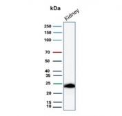 Western blot testing of human kidney tissue lysate with RBP4 antibody. Predicted molecular weight ~23 kDa.