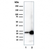 Western blot testing of human 1) liver and 2) kidney tissue with RBP4 antibody. Predicted molecular weight ~23 kDa.