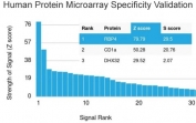 Analysis of HuProt(TM) microarray containing more than 19,000 full-length human proteins using RBP4 antibody. These results demonstrate the foremost specificity of the RBP4/4314 mAb. Z- and S- score: The Z-score represents the strength of a signal that an antibody (in combination with a fluorescently-tagged anti-IgG secondary Ab) produces when binding to a particular protein on the HuProt(TM) array. Z-scores are described in units of standard deviations (SD's) above the mean value of all signals generated on that array. If the targets on the HuProt(TM) are arranged in descending order of the Z-score, the S-score is the difference (also in units of SD's) between the Z-scores. The S-score therefore represents the relative target specificity of an Ab to its intended target.
