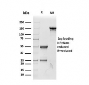 SDS-PAGE analysis of purified, BSA-free RBP4 antibody as confirmation of integrity and purity.
